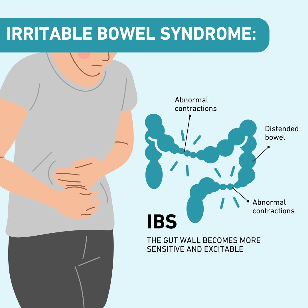 irritable bowel syndrome IBS